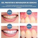 Gel Clareador e Protetor Gengival