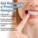 Gel Clareador e Protetor Gengival